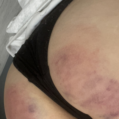 Spank